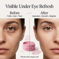 CollagenGlow Under Eye Patches