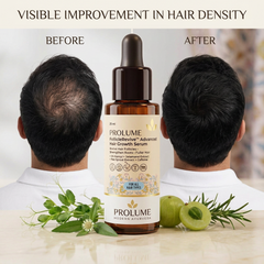FollicleRevive Advanced Hair Growth Serum  Root Activating Scalp Serum | Pea Sprout Extract Formula | Hair Strength Therapy | 60 ml