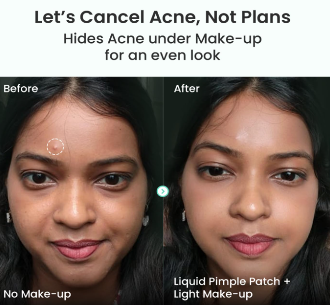 Invisible Liquid Pimple Patch