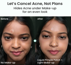 Invisible Liquid Pimple Patch
