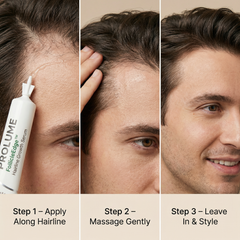 FollicleEdge Hairline Growth Serum  ~30ml | Narrow Pointed Dispenser Tube