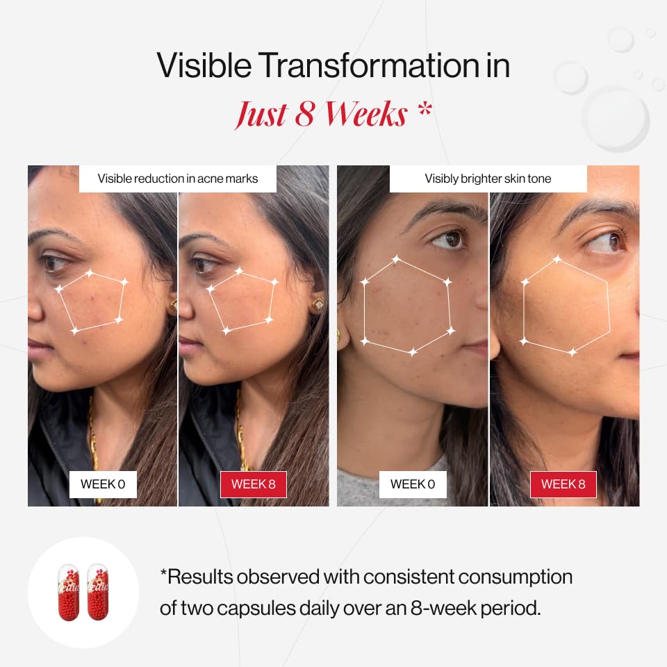 Prolume GlowBrilliance Complex