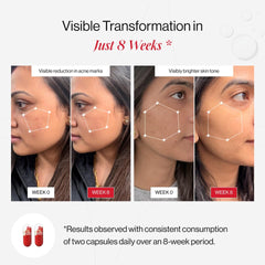 Prolume GlowBrilliance Complex