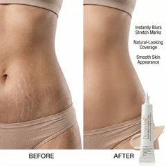 DermaVeil Stretch Mark Concealer Cream  ~30g | Narrow Pointed Dispenser Tube