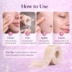 AcnePatch Roll