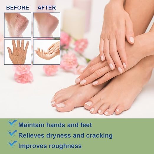 HeelRestore Cracked Heel Repair Balm