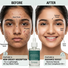 Salicylic Acid 2% Betaine 3% Pore Serum