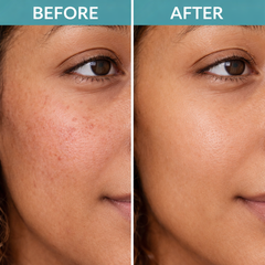 barrierfix moisturising and cleansing soap