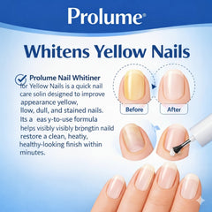 Nail Whitener for Yellow Nails