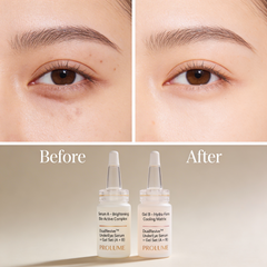 DualRevive UnderEye Serum + Gel Set (A + B) Set of 2 | Precision Injection-Type Bottles