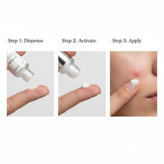 ClearFusion Powder-to-Cream Acne Treatment