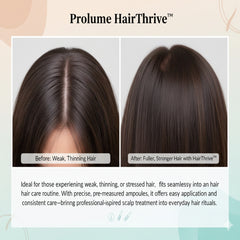 HairThrive™ Hair Growth Ampoule Kit