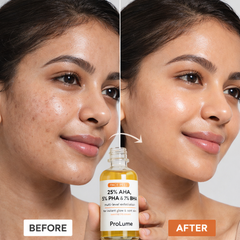 PeelOff Glow Solution  (25% AHA + 2% BHA + 5% PHA Peeling Solution – 20g | Deep Exfoliation + Instant Glow Reset)
