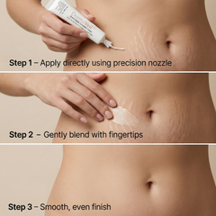 DermaVeil Stretch Mark Concealer Cream  ~30g | Narrow Pointed Dispenser Tube