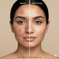 PigmentReset 5 Day Melasma Cure Kit