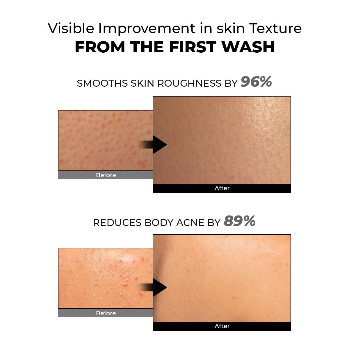 SmoothFix Exfoliating Body Wash