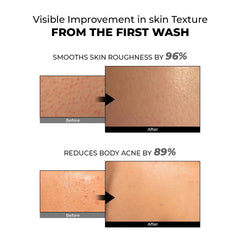 SmoothFix Exfoliating Body Wash