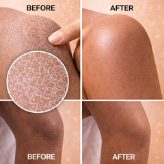 DewReset™  Instant Exfoliating Peel Spray