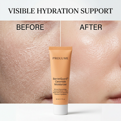 BarrierGuard Ceramide Moisturizer