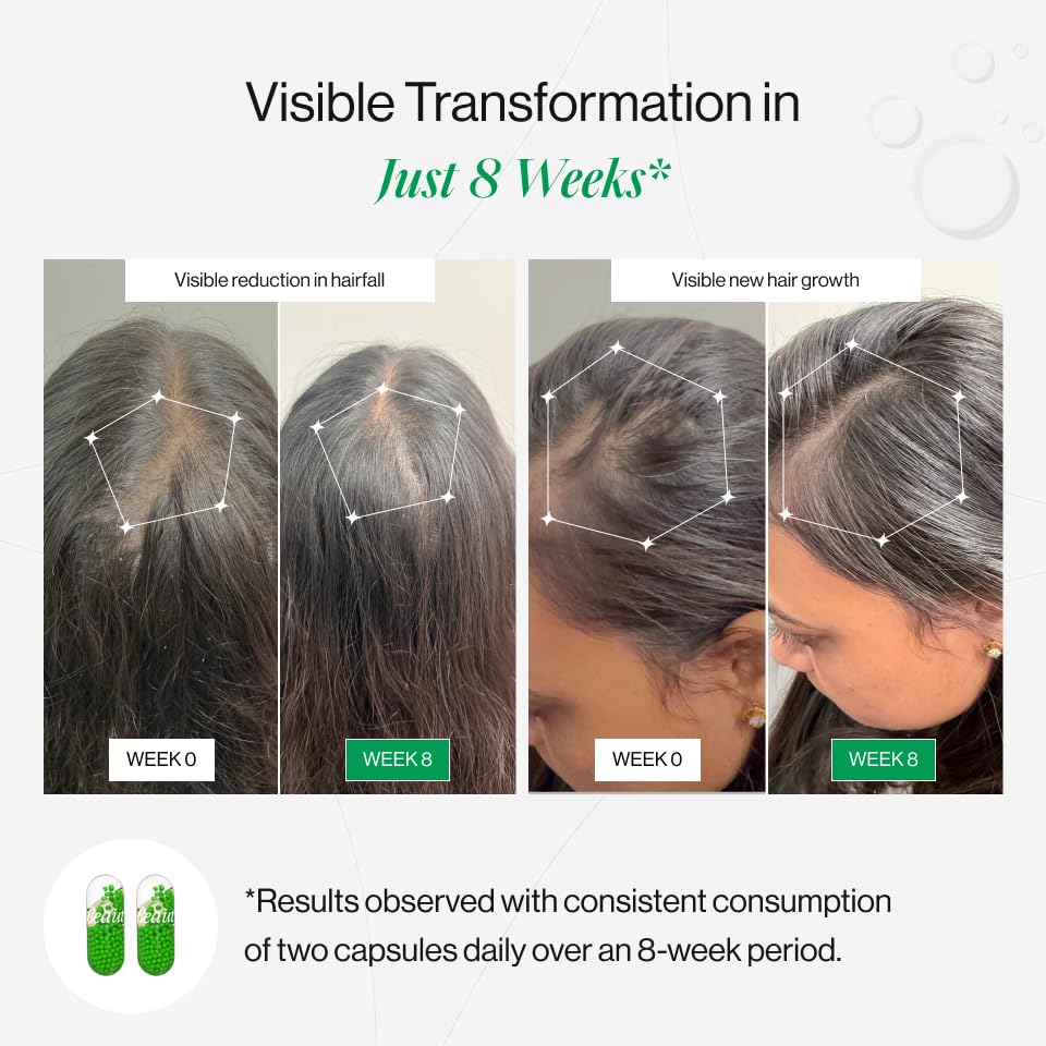 HairGrowth Catalyst | Hair Growth Accelerator Capsules