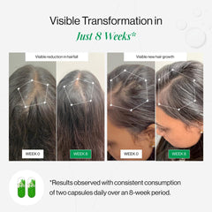 HairGrowth Catalyst | Hair Growth Accelerator Capsules