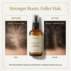 RiceGrow Ayurvedic Hair Growth Mist