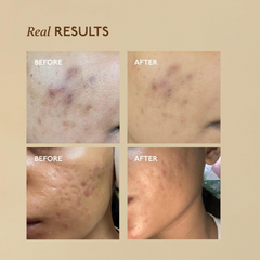 SpotFade Serum