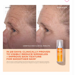 Glycolic Acid Resurfacing Serum
