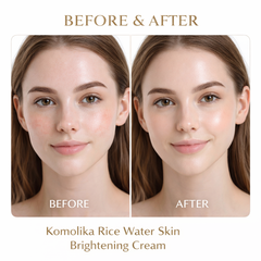 Komolika Rice Water Skin Brightening Cream
