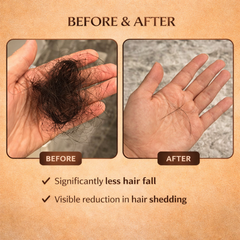ScalpBoost Herbal Hair Growth Oil Spray