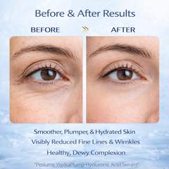 HydraPlump Hyaluronic Acid Serum