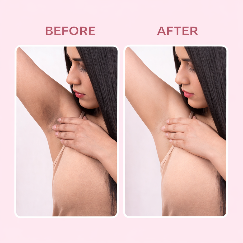 ToneBright Instant Spotlite Mask with Rose Petals Extract (For Dark Underarms, Neck & Full Body)