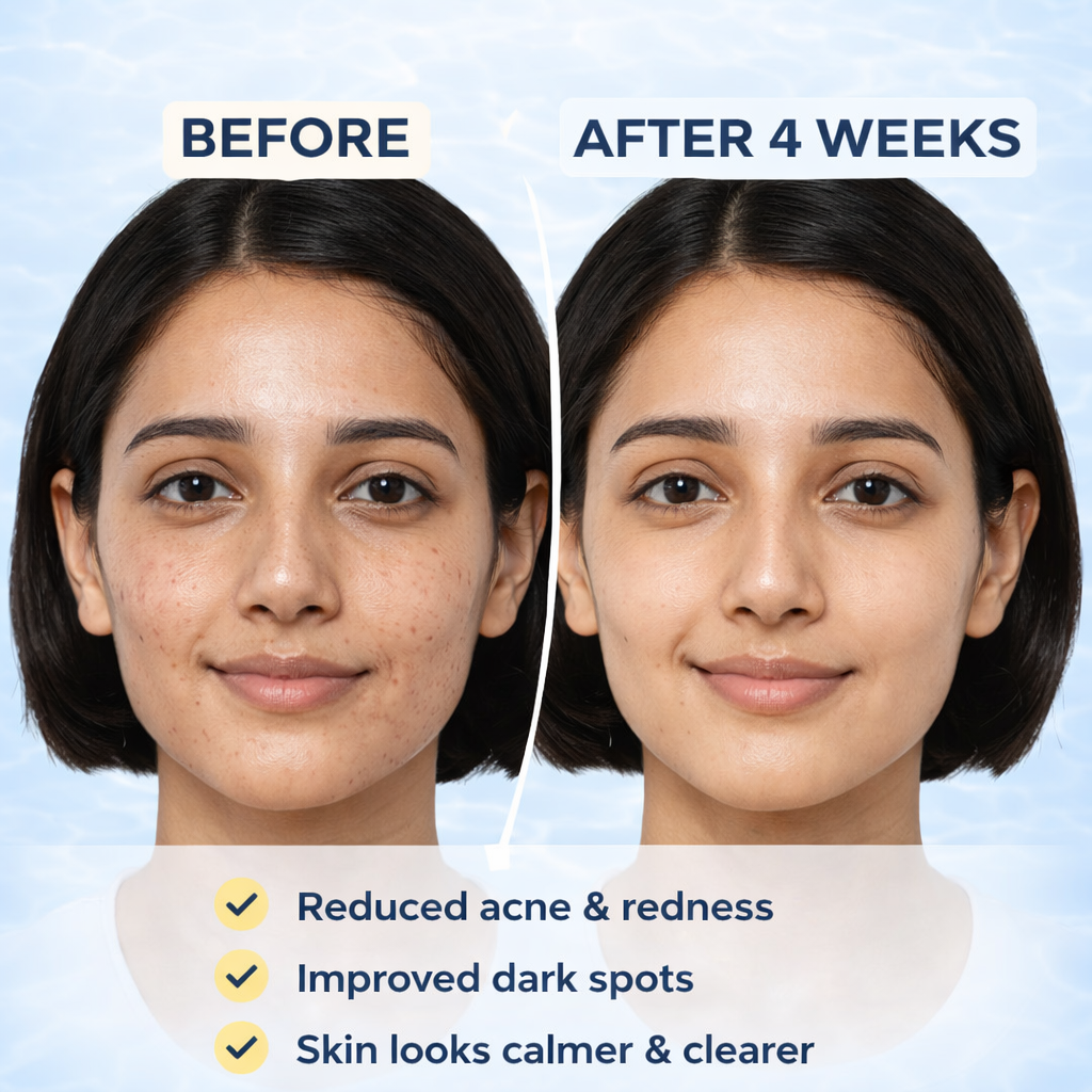 Hydraveil AquaShield Sunscreen Gel