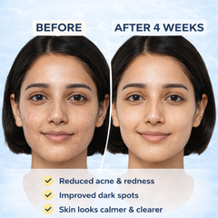 Hydraveil AquaShield Sunscreen Gel