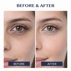 Under Eye Cream - Dark Circles Control