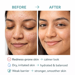 DermaBarrier CalmGel