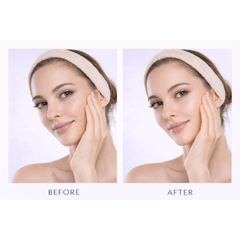SpotRefine™ Targeted Dark Spot Care Kit
