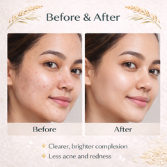 RiceGlow Face Mask Kit- Powder Mask + Activating Mist + Bowl + Brush