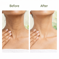 AloeFresh Instant Spotlite Mask with Aloe Vera Extracts