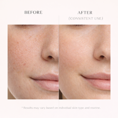 PoreReset Rice Peel Ampoule