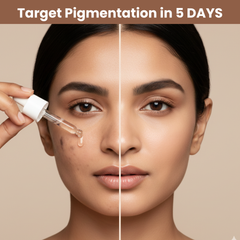 PigmentReset 5 Day Melasma Cure Kit