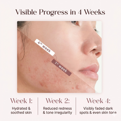 ClearTone Red Brightening Serum