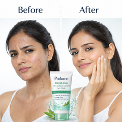DeepClean Oil & Sebium-Control Face Wash