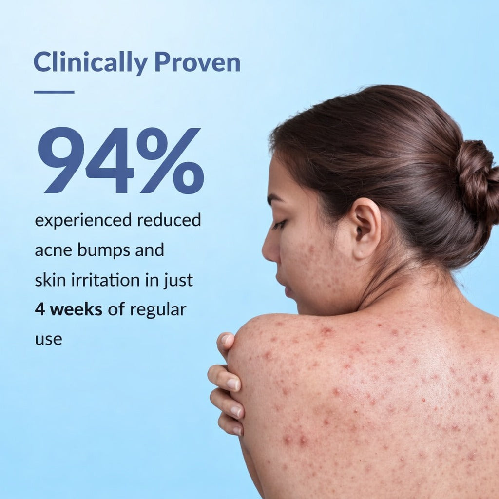 BodyAcne Warrior - Acne Control Spray  For Acne on Back, Shoulders & Neck