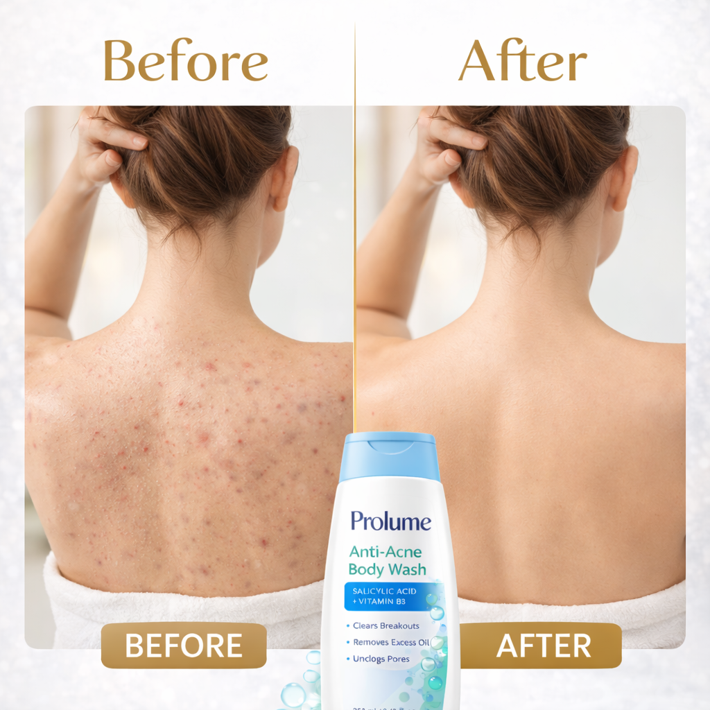 Anti-Acne Body Wash