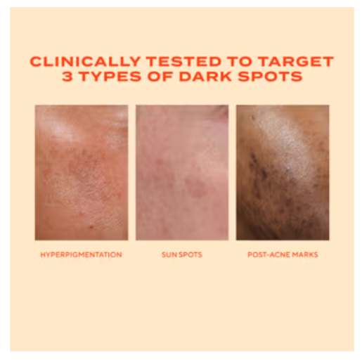 Glycolic Acid Resurfacing Serum