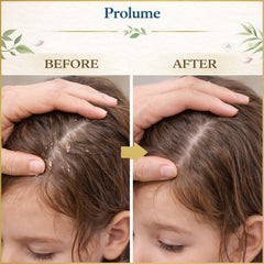 Lice Treatment (Ampoule + Syringe)