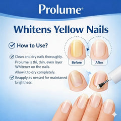 Nail Whitener for Yellow Nails