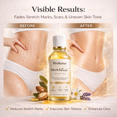 StretchFade Repair Oil  Advanced Skin Repair & Glow Elixir