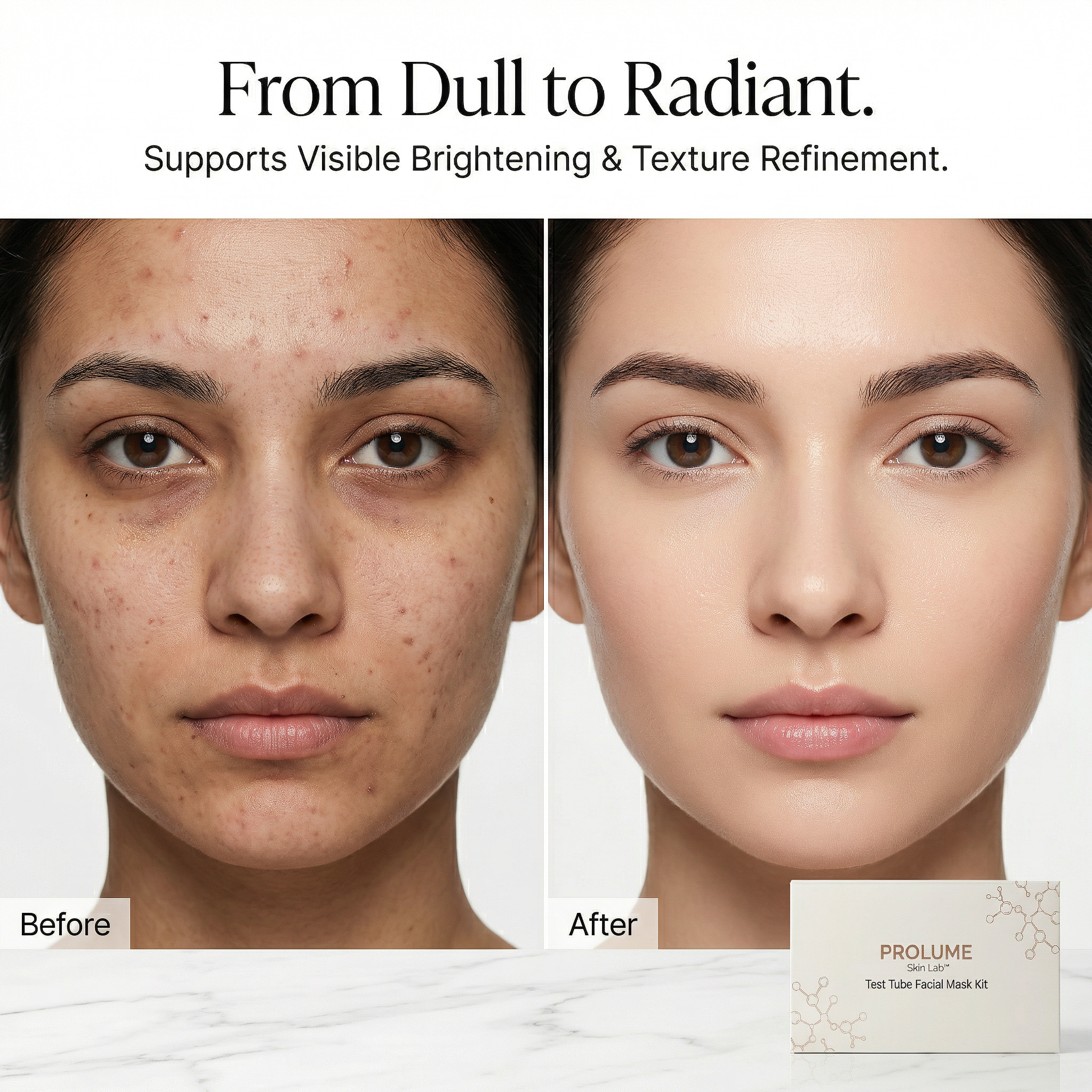 Skin Lab Test Tube Facial Mask Kit  Activated Powder + Liquid Treatment System  Lab Test Tube Packaging | 1 Test Tube + 5 Powder Sachets + 5 Liquid Ampoules